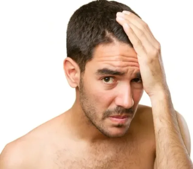 Psychological impact of hair loss Image