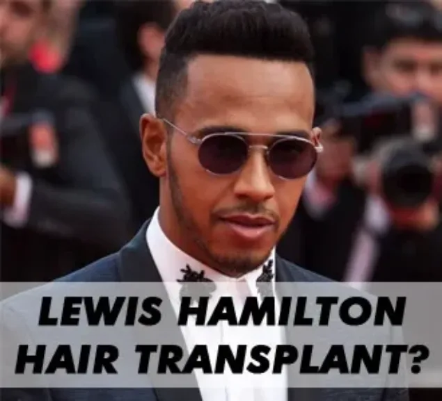 Has Lewis Hamilton had a hair transplant? Image